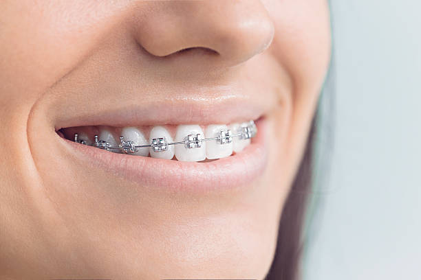 Best Wisdom Tooth Removal  in Wtmore Village, HI